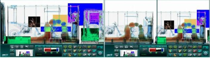 X-ray image S6000LV-01