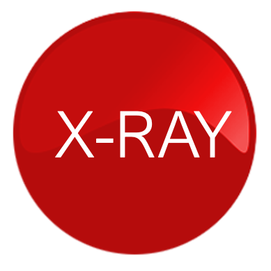 X-RAY